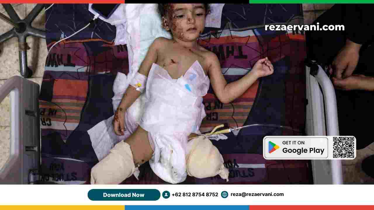 gaza_anak_amputasi