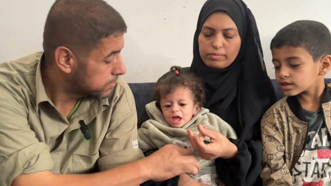 Rewan Aldreini hampir tidak bisa berbicara, menderita sistem kekebalan tubuh yang lemah, masalah jantung, dan kekurangan gizi parah di bawah pengepungan Israel di Gaza (MEE/Islam Ahmed).