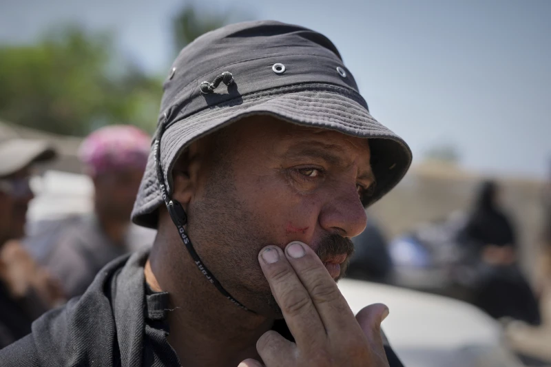 Jamil Atili, 51 tahun, memperlihatkan luka sayatan pisau di pipinya — luka yang ia katakan dialaminya saat berebut makanan di pusat distribusi yang dijalankan oleh kontraktor swasta Gaza Humanitarian Foundation di Jalur Gaza bagian selatan, ketika ia tiba dengan tangan kosong di Khan Younis, Rabu, 11 Juni 2025. (Foto AP/Abdel Kareem Hana)